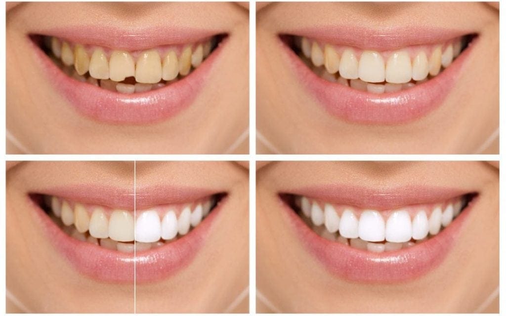 Cosmetic Dentistry