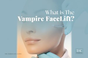 Vampire Facelift