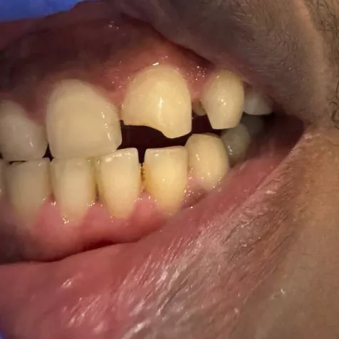 before-68fcb04d32b41